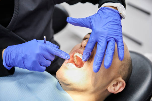 Best Knocked-Out Tooth (Avulsed Tooth) Treatment in Tahlequah, OK